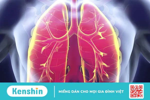 Chẩn đoán viêm phổi bằng cách nào?