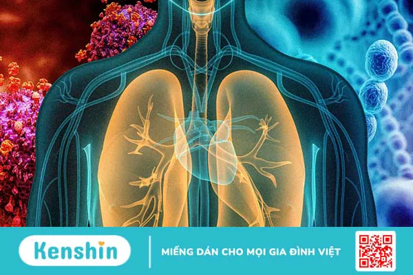 Chẩn đoán viêm phổi bằng cách nào?