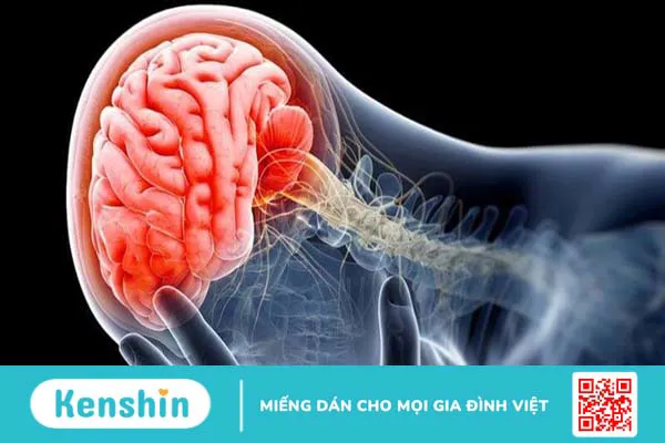 Chấn thương sọ não kín là gì? Triệu chứng, cách chẩn đoán và điều trị