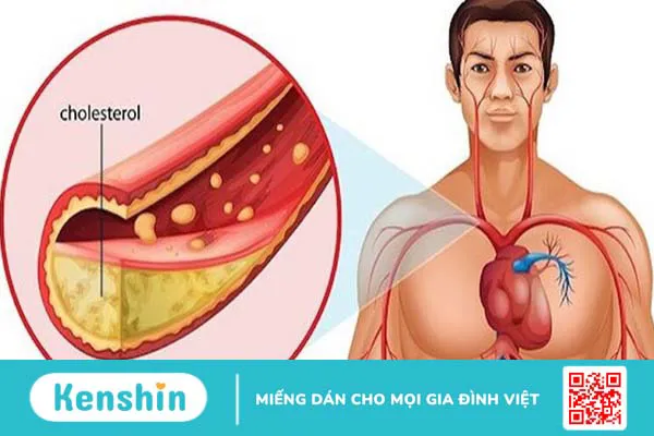 Chất béo tốt là gì? Những thực phẩm nào giàu chất béo tốt?