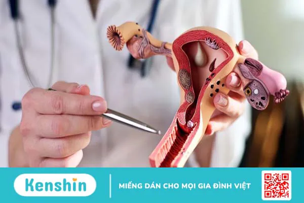 Chảy máu tử cung bất thường ở phụ nữ: Làm thế nào để nhận biết?