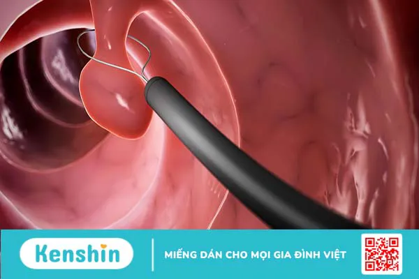 Chế độ ăn sau mổ polyp dây thanh thế nào để nhanh chóng hồi phục?