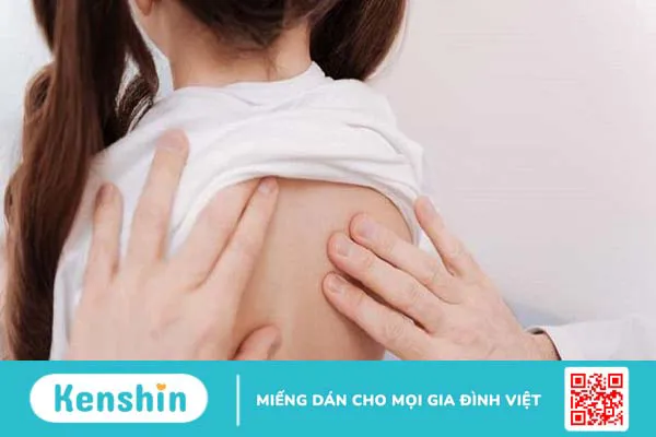 Chi phí mổ teo cơ delta là bao nhiêu? Cập nhật chi tiết nhất