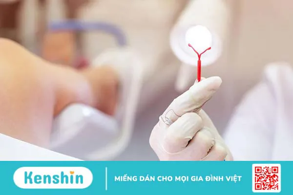 Chi phí tháo vòng tránh thai khoảng bao nhiêu? Khi nào nên tháo?