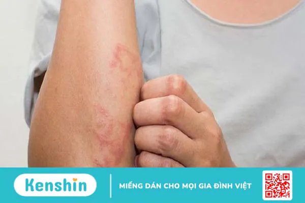 Chi phí xét nghiệm bệnh xã hội bao nhiêu tiền?