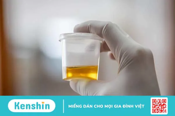 Chỉ số glucose trong nước tiểu có ý nghĩa gì?