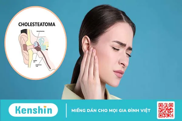 Cholesteatoma bẩm sinh là bệnh gì? Nguyên nhân, triệu chứng và cách điều trị