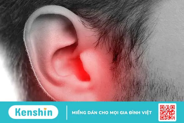 Cholesteatoma bẩm sinh là bệnh gì? Nguyên nhân, triệu chứng và cách điều trị