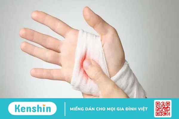 Cơ chế tái tạo máu là gì? Những điều bạn cần biết để nâng cao sức khỏe 3