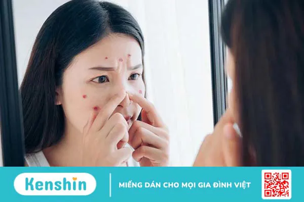 Có nên đắp mặt nạ đất sét hàng ngày không 4