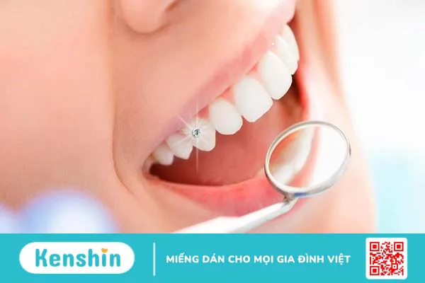 Có nên đính đá răng thẩm mỹ hay không?