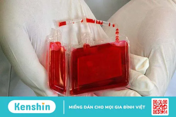 Có nên lưu trữ máu cuống rốn không? Điều cha mẹ muốn biết 3