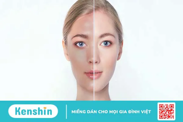 Có nên sử dụng kết hợp Ceramide và Vitamin C hay không? 2