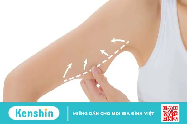 Có những phương pháp phẫu thuật thẩm mỹ cánh tay nào?