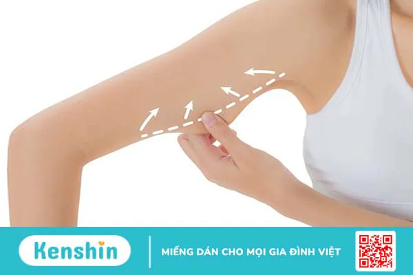 Có những phương pháp phẫu thuật thẩm mỹ cánh tay nào? 2