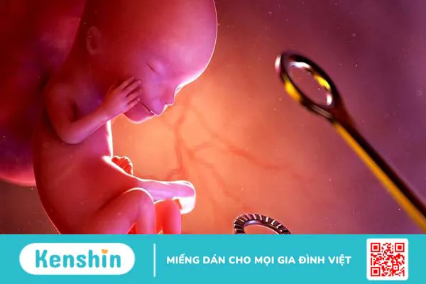 Có thai ngoài ý muốn phải làm sao? Những cách xử trí 3