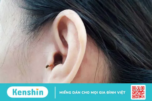 Côn trùng chui vào tai phải làm sao?