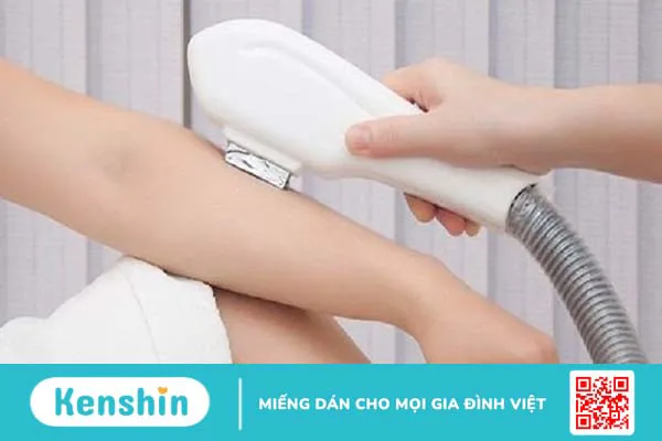 Công nghệ triệt lông Diode Laser – Triệt lông bằng công nghệ hiện đại