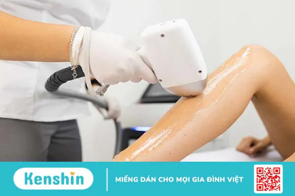 Công nghệ triệt lông Diode Laser - Triệt lông bằng công nghệ hiện đại 1