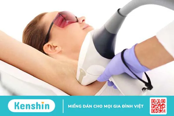 Công nghệ triệt lông Diode Laser - Triệt lông bằng công nghệ hiện đại 3