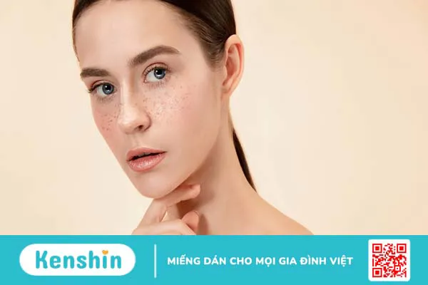 Da bị nám nhẹ do đâu? Cách điều trị hiệu quả cho làn da mới bị nám