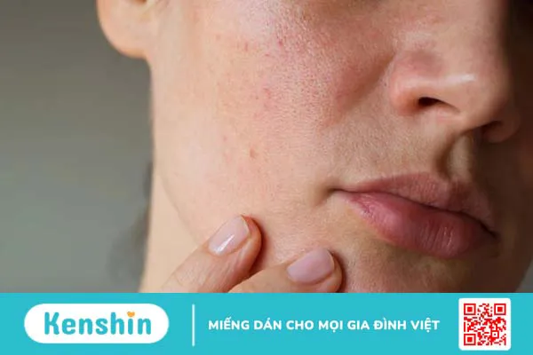 Hỏi đáp: Da dầu có nên dùng sữa rửa mặt tạo bọt không? 1