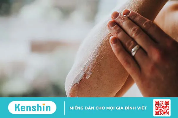 Da khô nghiêm trọng: Dấu hiệu, nguyên nhân và giải pháp