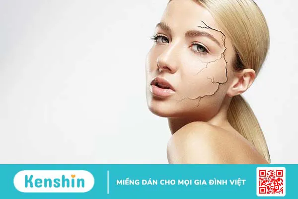 Da khô thiếu chất gì? Cách khắc phục hiệu quả