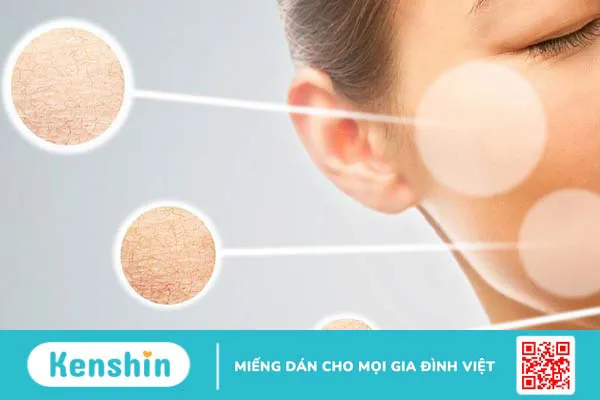 Da khô thiếu chất gì? Cách khắc phục hiệu quả 1