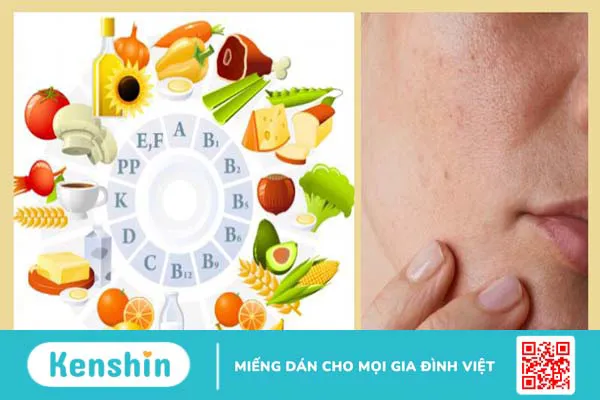 Da khô thiếu chất gì? Cách khắc phục hiệu quả 3