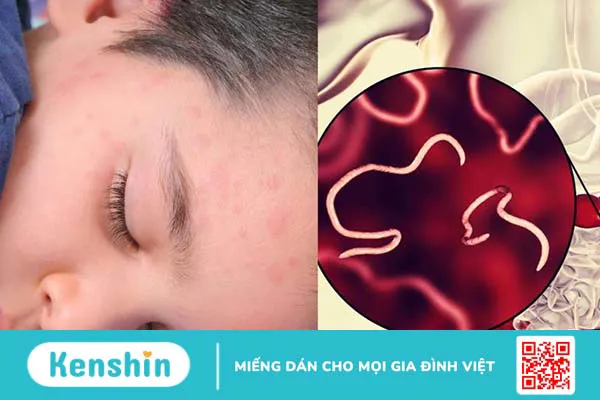 Da mặt bị ngứa châm chích có nguy hiểm không? Cách xử lý thế nào 2