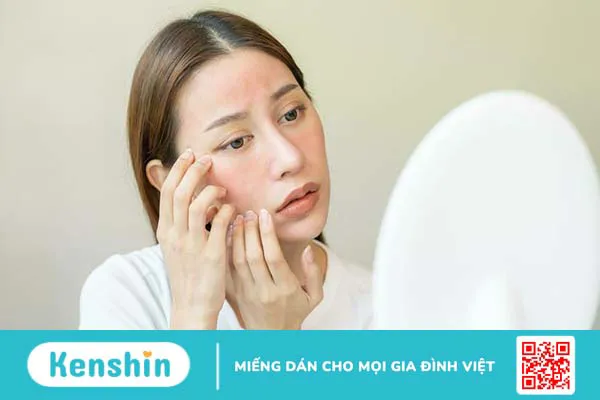 Da mặt bị ngứa sần sùi phải làm sao 1