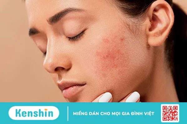 Da mặt chảy xệ: Nguyên nhân và cách hạn chế