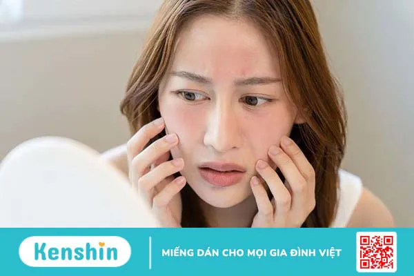 Da mặt nóng bừng và hồng đỏ cảnh báo bệnh lý gì 1