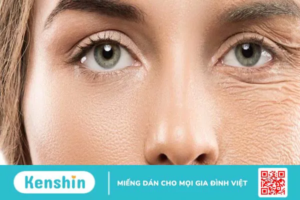 Da nhăn nheo: Cải thiện 5 thói quen xấu giúp bạn lấy lại làn da trẻ trung