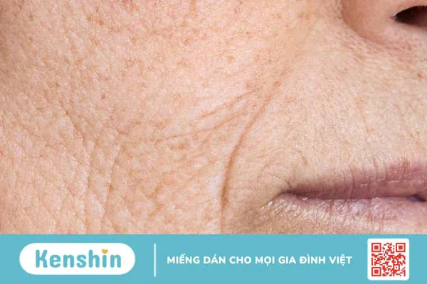 Da nhăn nheo: Cải thiện 5 thói quen xấu giúp bạn lấy lại làn da trẻ trung 2