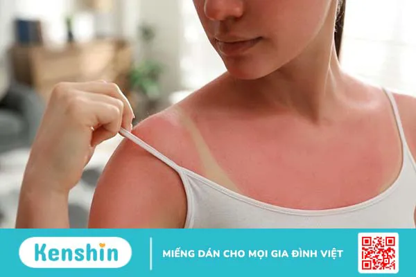 Da xấu: Nguyên nhân và cách cải thiện