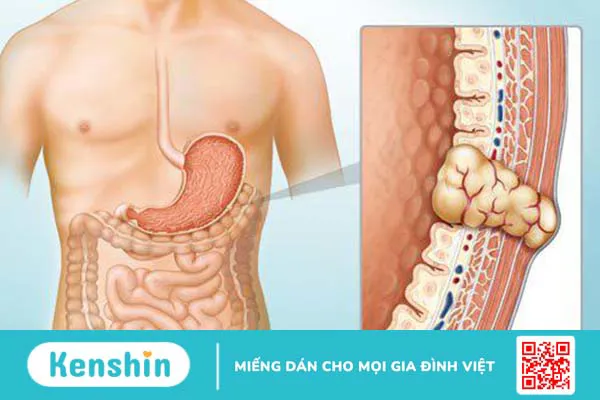 Đặc điểm cấu trúc và chức năng của cơ trơn đối với cơ thể