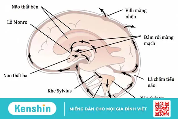 Dẫn lưu não thất được thực hiện khi nào? Quy trình phẫu thuật dẫn lưu não thất