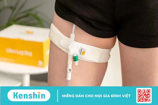 Dẫn lưu nước tiểu bàng quang được thực hiện khi nào?