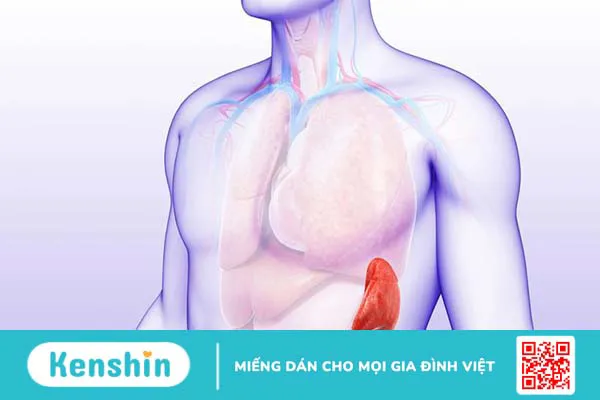 Dập lá lách cấp độ 2 có những đặc điểm gì? Các bước chẩn đoán bệnh nhân bị vỡ lách 1