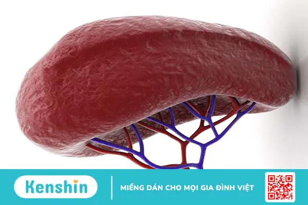 Dập lá lách cấp độ 2 có những đặc điểm gì? Các bước chẩn đoán bệnh nhân bị vỡ lách 3