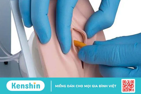 Đặt ống thông tiểu khi mổ đẻ tại sao lại cần thiết?