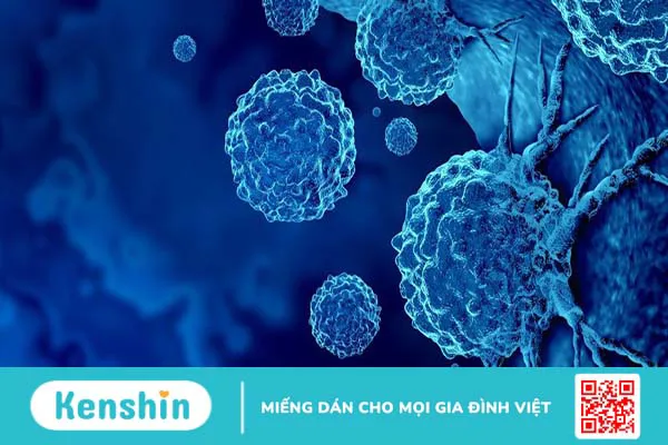 Dấu ấn khối u là gì? Vai trò của dấu ấn khối u trong bệnh ung thư