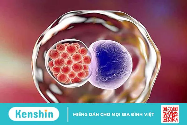 Đau bụng dưới âm ỉ là do những bệnh lý gì? 3