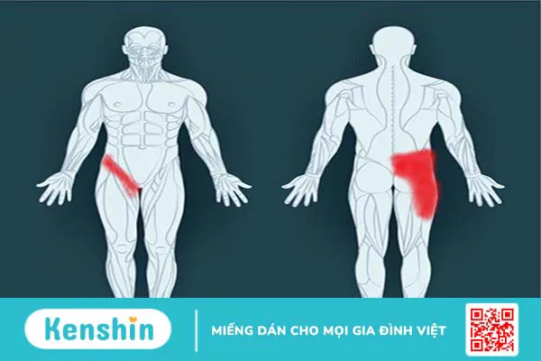 Đau cơ háng có nguy hiểm không? Phải làm gì để phòng ngừa? 1