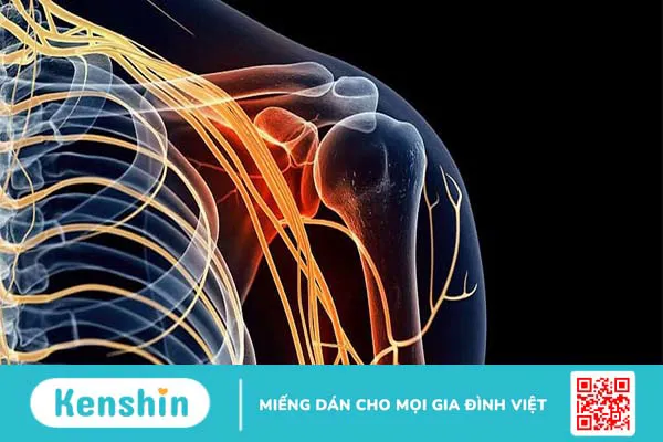 Đau dây thần kinh ngoại biên: Nguyên nhân và cách điều trị