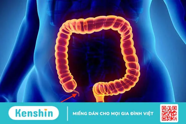 Đau eo bên phải có sao không? Nguyên nhân và cách điều trị