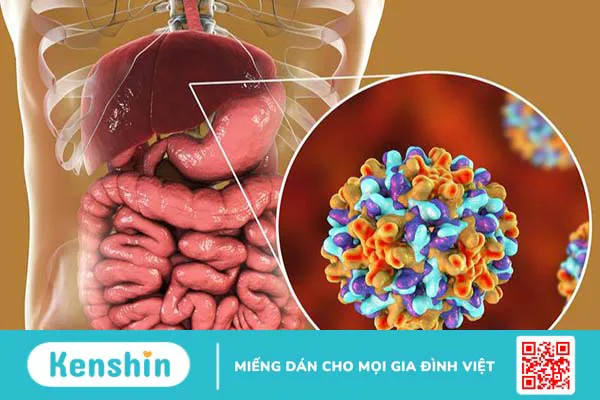 Đau eo bên phải có sao không? Nguyên nhân và cách điều trị