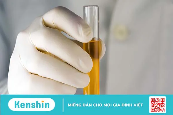 Dấu hiệu bàng quang có vấn đề và cách giúp bàng quang được khỏe mạnh